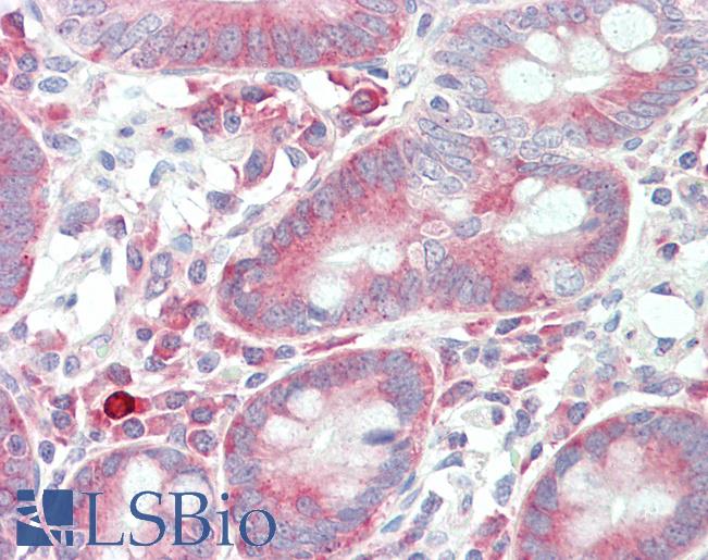 Anti-CASKIN1 antibody IHC staining of human small intestine. Immunohistochemistry of formalin-fixed, paraffin-embedded tissue after heat-induced antigen retrieval.