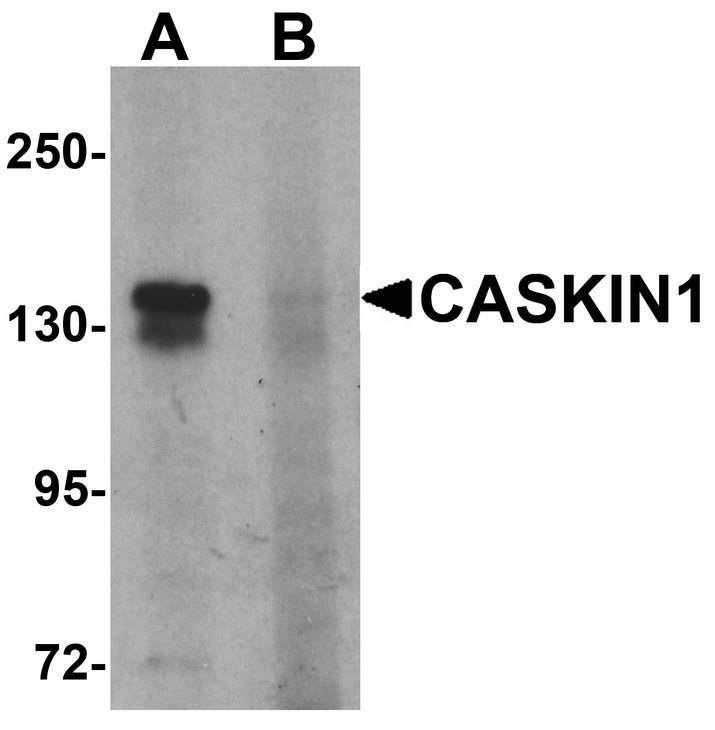 Western blot analysis of CASKIN1 in HeLa cell lysate with CASKIN1 antibody at 1 ug/ml in (A) the absence and (B) the presence of blocking peptide.
