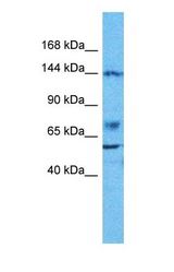 Western blot of CSKI2 Antibody with human Jurkat Whole Cell lysate.