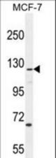 CASKIN2 Antibody western blot of MCF-7 cell line lysates (35 ug/lane). The CASKIN2 antibody detected the CASKIN2 protein (arrow).