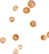 Immunocytochemistry of CASKIN2 in HeLa cells with CASKIN2 antibody at 2.5 µg/mL.