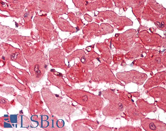 Human Heart: Formalin-Fixed, Paraffin-Embedded (FFPE)