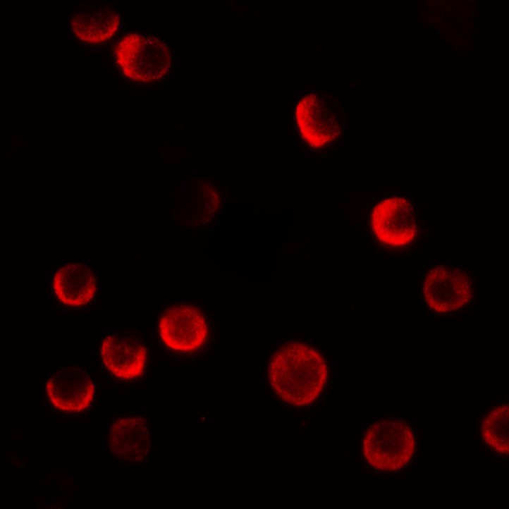 Immunofluorescence of CASKIN2 in HeLa cells with CASKIN2 antibody at 20 µg/mL.