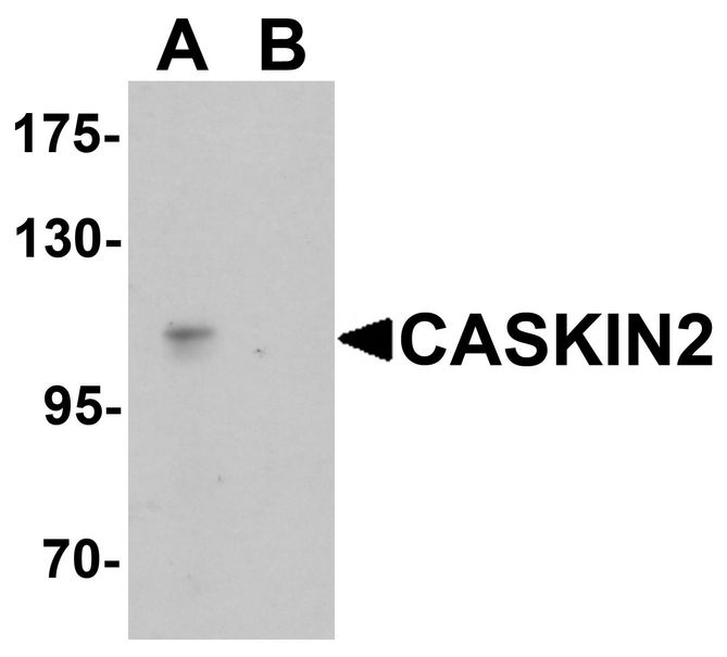 Western blot analysis of CASKIN2 in HeLa cell lysate with CASKIN2 antibody at 1 ug/ml in (A) the absence and (B) the presence of blocking peptide.