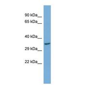 Western blot of Human HepG2. CRTAP antibody dilution 1.0 ug/ml.