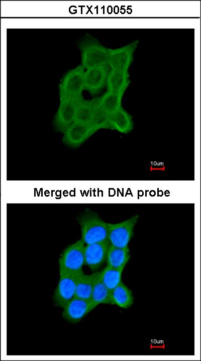 Immunofluorescence of paraformaldehyde-fixed A431 using Cartilage-associated protein antibody at 1:200 dilution.