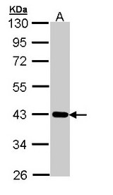 Sample (30 ug of whole cell lysate). A: A431 . 10% SDS PAGE. CASP / CRTAP antibody diluted at 1:1000