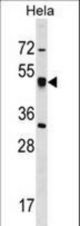 CRTAP Antibody western blot of HeLa cell line lysates (35 ug/lane). The CRTAP antibody detected the CRTAP protein (arrow).