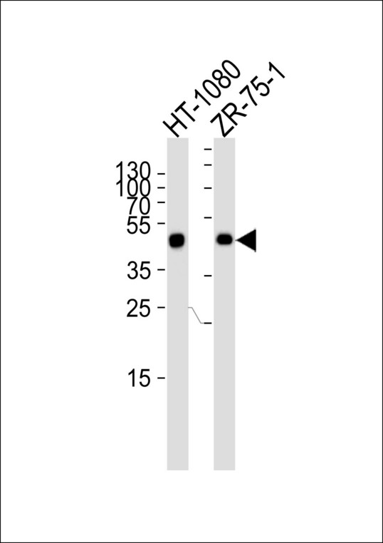 Western blot of lysates from HT-1080, ZR-75-1 cell line (from left to right), using CRTAP Antibody. Antibody was diluted at 1:1000 at each lane. A goat anti-rabbit IgG H&L (HRP) at 1:5000 dilution was used as the secondary antibody. Lysates at 35ug per lane.