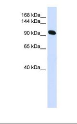 Fetal muscle lysate. Antibody concentration: 1.0 ug/ml. Gel concentration: 6-18%.