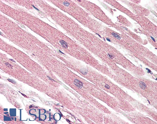 Anti-Caspase 1 antibody IHC of human heart. Immunohistochemistry of formalin-fixed, paraffin-embedded tissue after heat-induced antigen retrieval. Antibody LS-B3200 concentration 5 ug/ml.