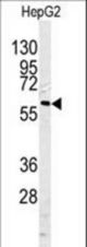 Western blot of CASP10 antibody in HepG2 cell line lysates (35 ug/lane). CASP10 (arrow) was detected using the purified antibody.