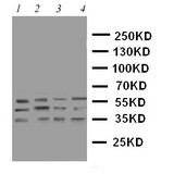 WB of CASP12 / Caspase 12 antibody. Lane 1: PANC Cell Lysate. Lane 2: SMMC Cell Lysate. Lane 3: A549 Cell Lysate. Lane 4: HELA Cell Lysate.