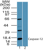 Western blot of Caspase-12 in human heart lysate in the 1) absence and 2) presence of immunizing peptide using Caspase-12 antibody at 1 ug/ml. Goat anti-rabbit Ig HRP secondary antibody, and PicoTect ECL substrate solution, were used for this test.
