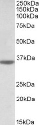 CASP12 antibody (0.5 ug/ml) staining of Human Heart lysate (35 ug protein in RIPA buffer). Primary incubation was 1 hour. Detected by chemiluminescence.