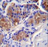 CASP12 Antibody immunohistochemistry of formalin-fixed and paraffin-embedded human stomach tissue followed by peroxidase-conjugated secondary antibody and DAB staining.