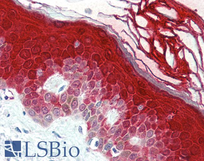 Anti-Caspase 14 antibody IHC of human skin. Immunohistochemistry of formalin-fixed, paraffin-embedded tissue after heat-induced antigen retrieval. Antibody LS-B474 concentration 5 ug/ml.
