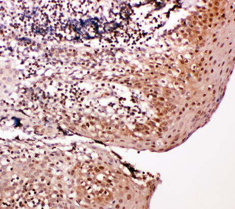 CASP14 / Caspase 14 antibody. IHC(P): Human Tonsil Tissue.