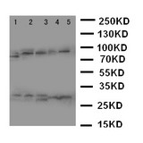 WB of CASP14 / Caspase 14 antibody. Lane 1: Rat Brain Tissue Lysate. Lane 2: Rat Liver Tissue Lysate. Lane 3: Rat Spleen Tissue Lysate. Lane 4: A431 Cell Lysate. Lane 5: NIH3T3 Cell Lysate..