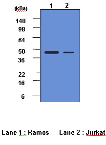 Cell lysates of Ramos and Jurkat (each 40 ug) were resolved by SDS-PAGE, transferred to PVDF membrane and probed with anti-human Caspase-2(1:500). Proteins were visualized using a goat anti-mouse secondary antibody conjugated to HRP and a ECL detection system. Lane 1: Ramos; Lane 2: Jurkat.
