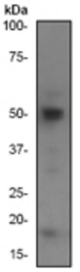 Western blot analysis on Jurkat cell lysate using anti-Caspase-2 antibody, dilution 1:500.