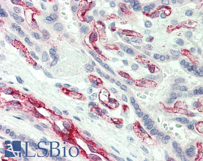 Anti-CASP2 / Caspase 2 antibody IHC of human placenta. Immunohistochemistry of formalin-fixed, paraffin-embedded tissue after heat-induced antigen retrieval. Antibody LS-B475 concentration 10 ug/ml.