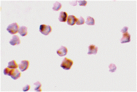 Immunocytochemistry of caspase-2 in A-20 cells with caspase-2 antibody at 2 ug/ml.