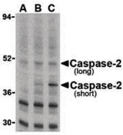 Western blot of caspase-2 in Ramos cells with caspase-2 antibody at (A) 0.5, (B) 1, and (C) 2 ug/ml.