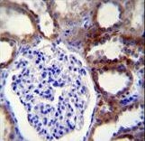 CASP3 Antibody immunohistochemistry of formalin-fixed and paraffin-embedded human kidney tissue followed by peroxidase-conjugated secondary antibody and DAB staining.