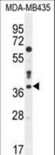 CASP3 Antibody western blot of MDA-MB435 cell line lysates (35 ug/lane). The CASP3 antibody detected the CASP3 protein (arrow).