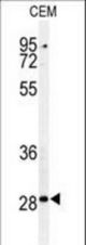 Western blot of CASP3 (Asp175) Antibody in CEM cell line lysates (35 ug/lane). CASP3 (arrow) was detected using the purified antibody.