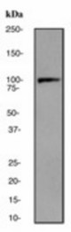Western blot analysis on human skeletal muscle lysate using anti-alpha-actinin 3 antibody (LS-C105287), dilution 1:10000.