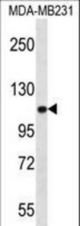 ACTN3 Antibody western blot of MDA-MB231 cell line lysates (35 ug/lane). The ACTN3 antibody detected the ACTN3 protein (arrow).