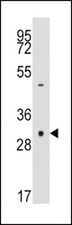 Western blot of anti-CASP3 antibody in NCI-H460 cell line lysates (35 ug/lane). CASP3 (arrow) was detected using the purified antibody.
