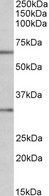 CASP3 antibody (1 ug/ml) staining of MOLT4 lysate (35 ug protein in RIPA buffer). Primary incubation was 1 hour. Detected by chemiluminescence.
