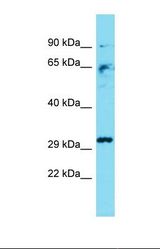 Western blot of Mouse Liver. Casp3 antibody dilution 1.0 ug/ml.