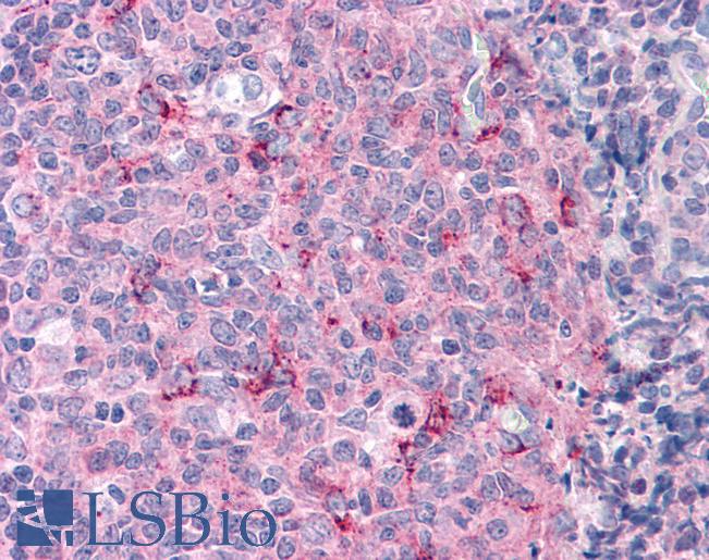 Anti-Caspase 3 antibody IHC of human tonsil. Immunohistochemistry of formalin-fixed, paraffin-embedded tissue after heat-induced antigen retrieval. Antibody LS-B4706 concentration 5 ug/ml.