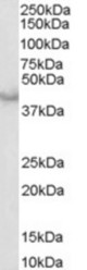 Antibody (0.3 ug/ml) staining of Human Heart lysate (35 ug protein in RIPA buffer). Primary incubation was 1 hour. Detected by chemiluminescence.