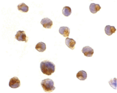 Immunocytochemistry of caspase-6 in Jurkat cells with caspase-6 antibody at 2 ug/ml.
