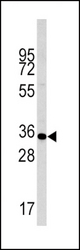 Western blot of anti-Phospho-Caspase-pS257 in liver cell line lysates (35 ug/lane). Casp6-pS257(arrow) was detected using the purified antibody.