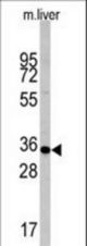 Western blot of anti-CASP6 Antibody in mouse liver tissue lysates (35 ug/lane). CASP6 (arrow) was detected using the purified antibody.