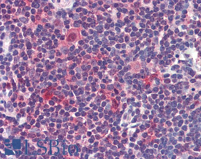 Anti-Caspase 7 antibody IHC of human thymus. Immunohistochemistry of formalin-fixed, paraffin-embedded tissue after heat-induced antigen retrieval. Antibody LS-B3794 concentration 5 ug/ml.