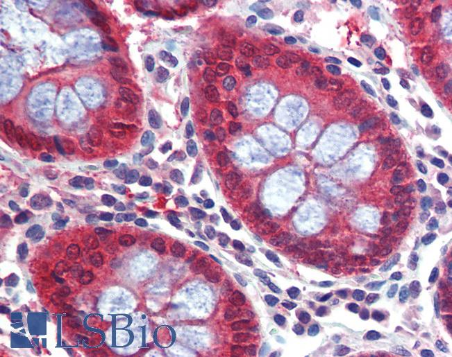 Anti-Caspase 7 antibody IHC of human colon. Immunohistochemistry of formalin-fixed, paraffin-embedded tissue after heat-induced antigen retrieval. Antibody LS-B3794 concentration 5 ug/ml.
