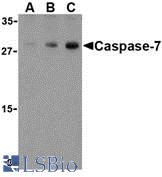 Western blot of caspase-7 in Human skeletal muscle cell lysate with caspase-7 antibody at (A) 0.5, (B) 1, and (C) 2 ug/ml.