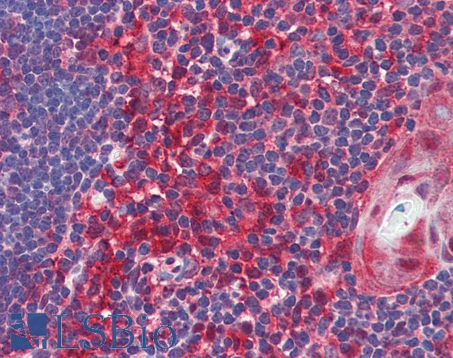 Anti-Caspase 8 antibody IHC of human thymus. Immunohistochemistry of formalin-fixed, paraffin-embedded tissue after heat-induced antigen retrieval. Antibody LS-B3796 concentration 5 ug/ml.