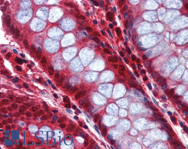 Anti-Caspase 8 antibody IHC of human colon. Immunohistochemistry of formalin-fixed, paraffin-embedded tissue after heat-induced antigen retrieval. Antibody LS-B3796 concentration 5 ug/ml.