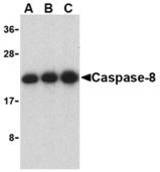 Western blot of caspase-8 in Jurkat cell lysate with caspase-8 antibody at (A) 0.5, (B) 1, and (C) 2 ug/ml.