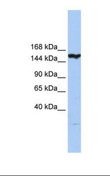Hela cell lysate. Antibody concentration: 1.0 ug/ml. Gel concentration: 6%-18%.
