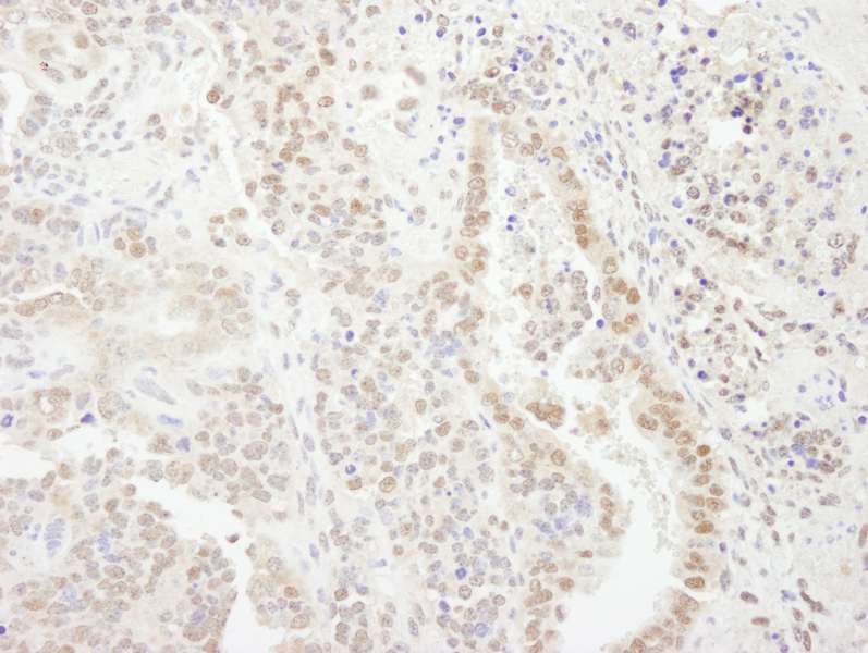 Detection of Mouse FLASH by Immunohistochemistry. Sample: FFPE section of mouse teratoma. Antibody: Affinity purified rabbit anti-FLASH used at a dilution of 1:250.