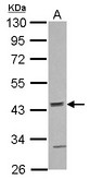 Sample (30 ug of whole cell lysate) A: NT2D1 10% SDS PAGE ACTR10 antibody diluted at 1:1000